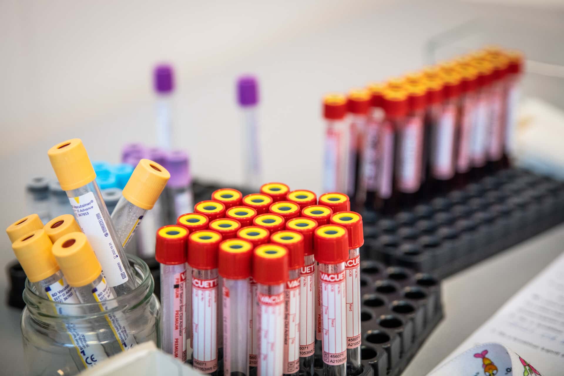 jek_antigen (12 of 17).jpg_compressed