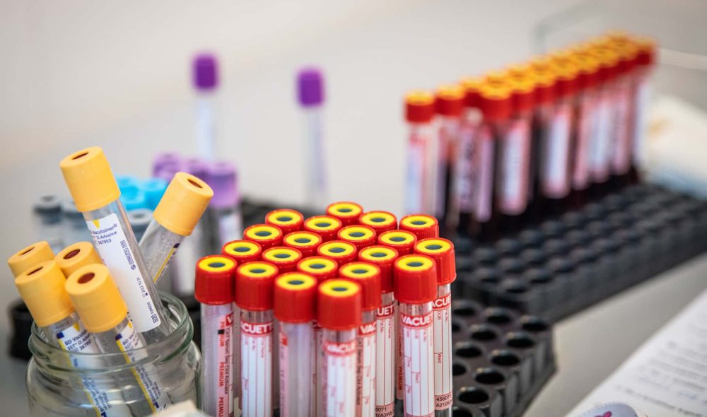 jek_antigen (12 of 17).jpg_compressed