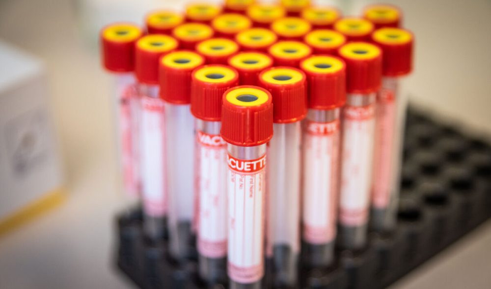 jek_antigen (3 of 17).jpg_compressed